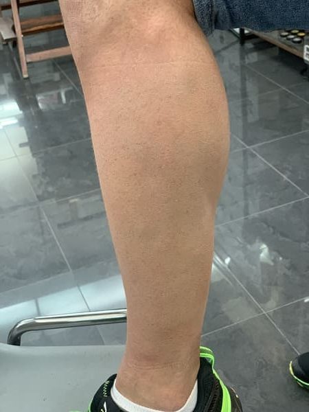 Tatuaje tapado - Lucía Castro